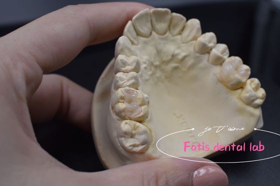 Tùy chỉnh Modern Dental Inlay And Onlay Ứng dụng đa năng