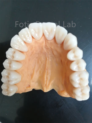 Zirconia đa lớp tiên tiến cho khả năng mòn và chống ăn mòn vượt trội