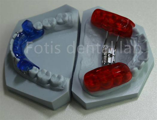 Lưu giữ răng hiệu quả phòng thí nghiệm nha khoa giữ không gian chỉnh nha cho mở rộng răng