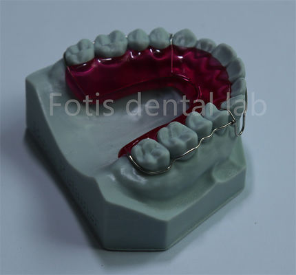 Phương pháp giữ răng chính là giải pháp thoải mái và giá cả phải chăng