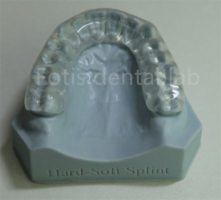 Điều chỉnh và tùy chỉnh gia cầm chỉnh nha gia tăng để giữ răng và mở rộng
