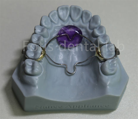 Phòng thí nghiệm nha khoa giá cả phải chăng Mẫu gia mở răng có hiệu quả trong việc giữ và mở rộng răng