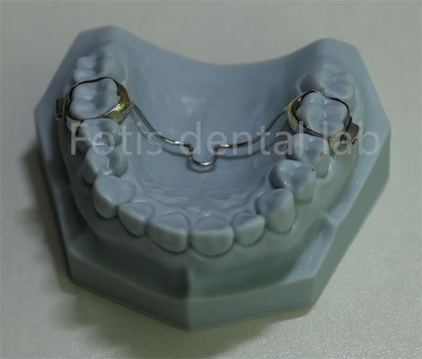 Phương pháp mở rộng răng đa năng - Phương pháp hợp lý cho hầu hết các phương pháp điều trị chỉnh nha