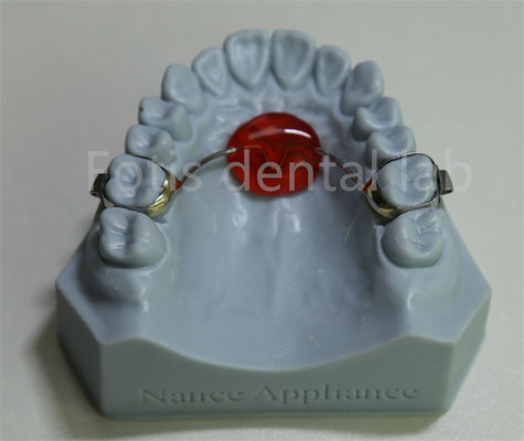 Phòng thí nghiệm nha khoa Phương pháp mở rộng miệng có giá cả phải chăng và tương thích với hầu hết các phương pháp điều trị