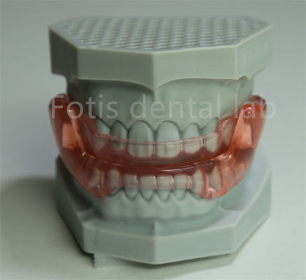 OEM Orthodontic Retainer Expander Tất cả các kích thước tương thích với hầu hết các phương pháp điều trị chỉnh nha