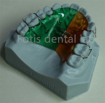 Máy giữ răng đa năng và thoải mái để giữ răng hiệu quả