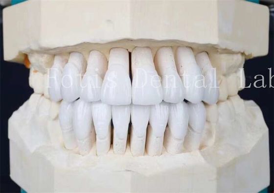 Xi măng kết dính và lớp phủ nhựa tổng hợp bền cao