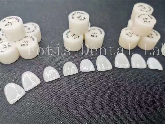 Tùy chỉnh Phòng thí nghiệm nha khoa Laminate veneers với độ bền và độ bền cao