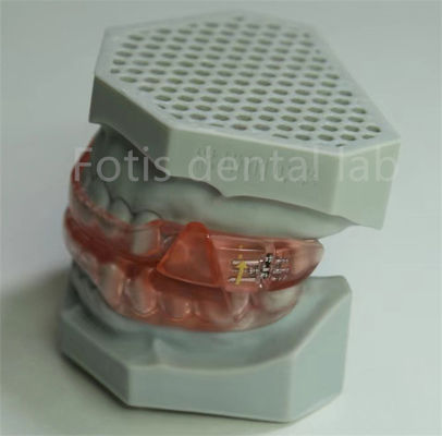 Phòng thí nghiệm nha khoa giá cả phải chăng Hyrax Expander Orthodontic Retainer Dễ dàng để làm sạch và bảo trì